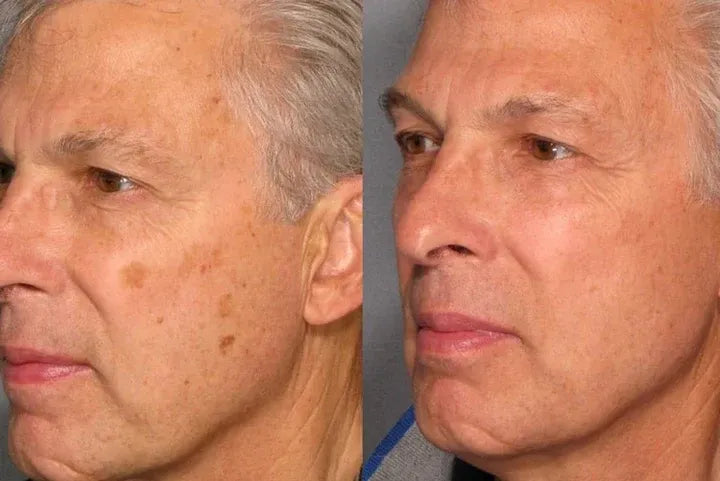 Dark Spot Correcting Cream