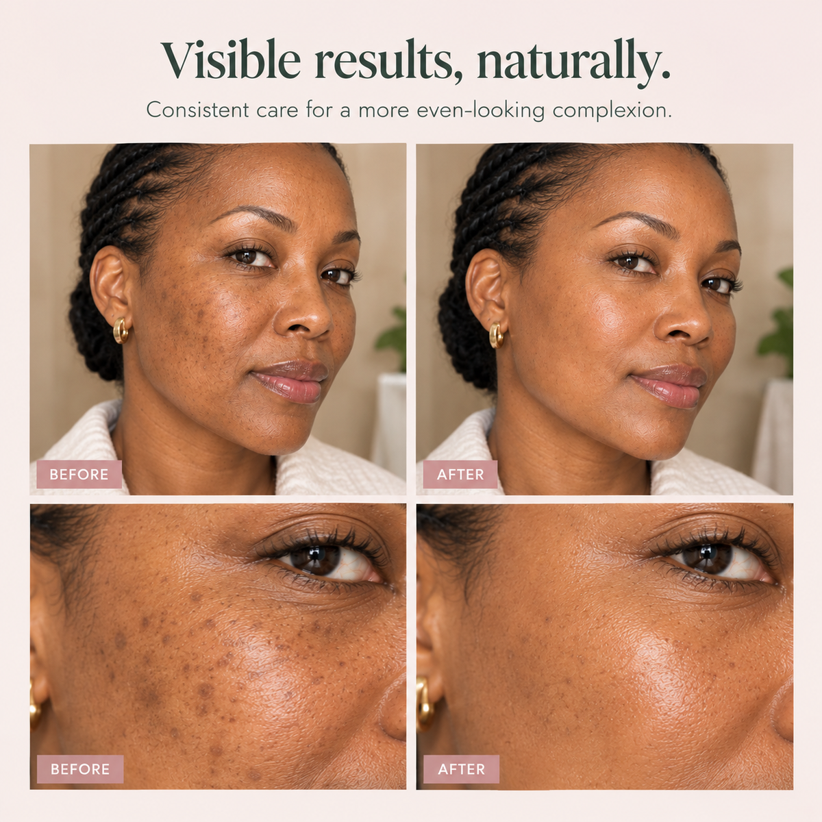 Dark Spot Correcting Cream
