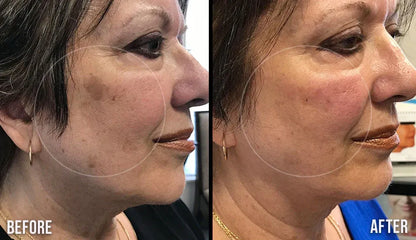 Dark Spot Correcting Cream