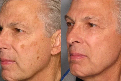 Dark Spot Correcting Cream